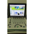 MSLPU34A portable 3d ultrasound scanner